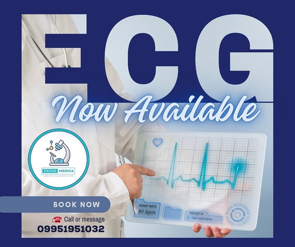 ECG heart monitoring service at Prima Medica